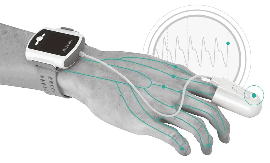 Dispositivo WatchPAT 300 indossato per polisonnografia domiciliare al TB Medical Center