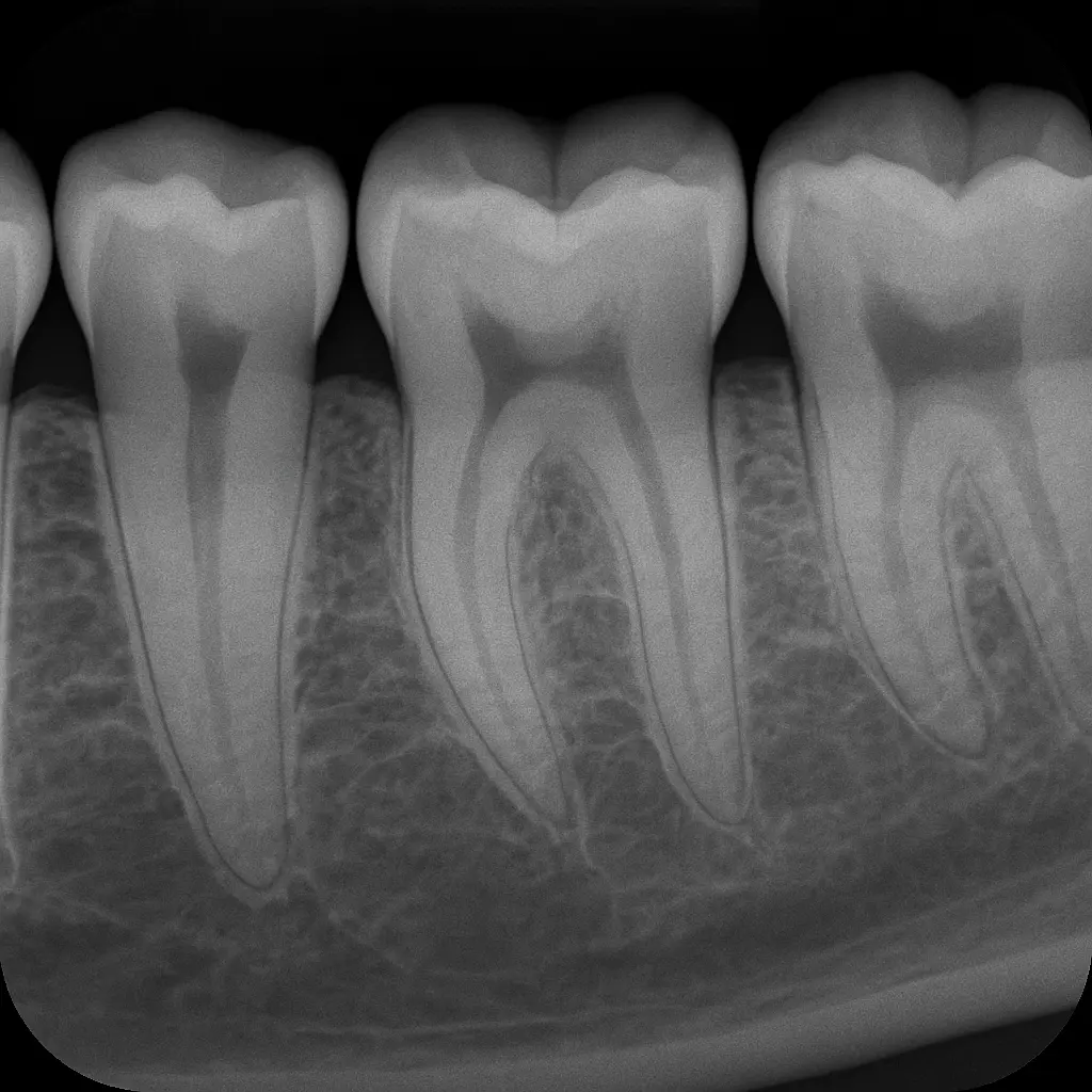 Dispositivo per radiografia endorale RVG utilizzato al TB Medical Center